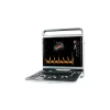 EBIT 50 ULTRASONIDO 4 11zon