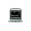 ECO 2 ULTRASONIDO DOPPLER 4 11zon