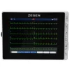 Electrocardiógrafo ZGN-60