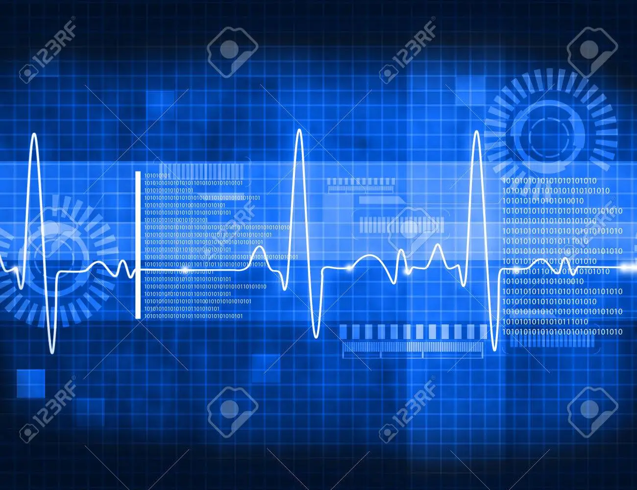 EL ELECTROCARDIOGRAMA COMO EL SISTEMA DE MEDIDA DE LA HUELLA ELÉCTRICA DEL CORAZÓN