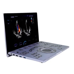 SONOAIR 60 ULTRASONIDO PORTATIL 4