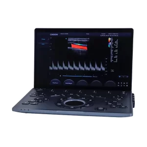 Ultrasonido Portátil Sonoair-30 sobre carro médico