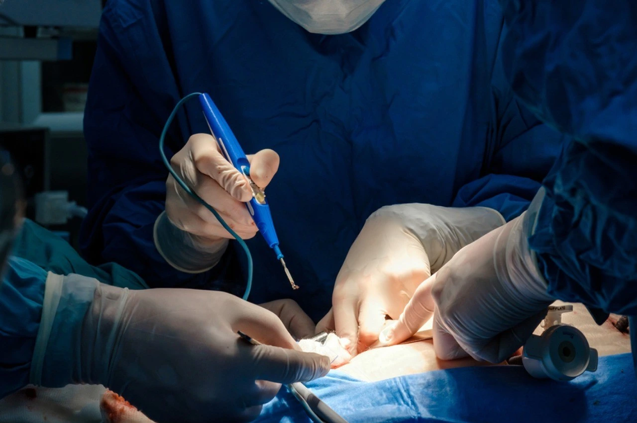 Electrocirugía Monopolar vs. Bipolar