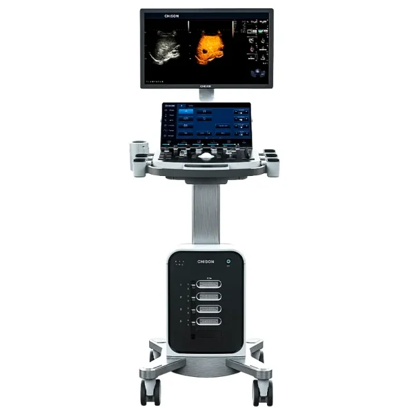 Ultrasonido Chison SonoMax 7